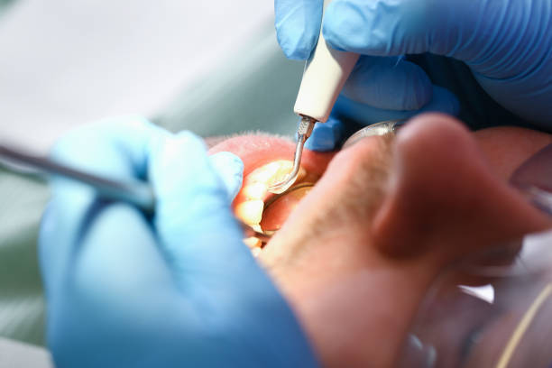 Best Emergency Root Canal Therapy in Rossville, MD