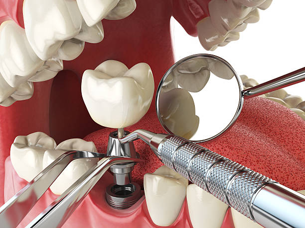 Best Emergency Care for Gum Disease in Rossville, MD